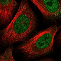 FoxC1 Antibody, Novus Biologicals 25 &mu;L; Unlabeled:Antibodies, Polyclonal